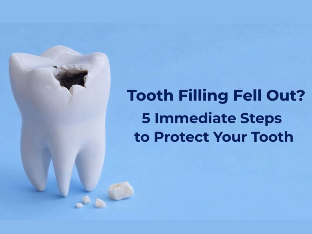 Tooth Filling Fell Out? 5 Immediate Steps to Protect Your Tooth